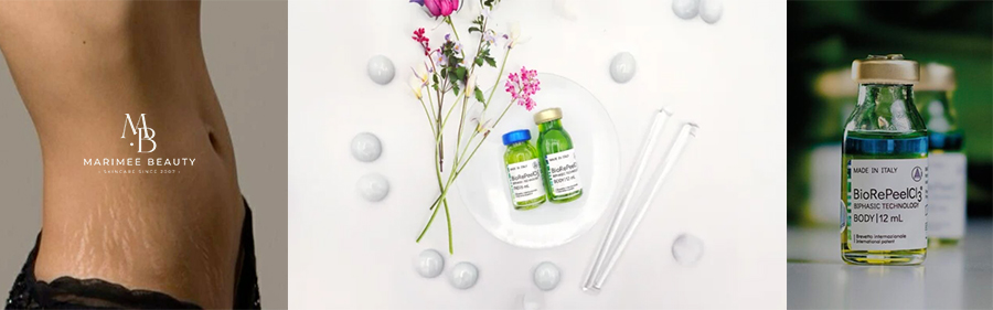 Biorepeel kehale koos mikroneedlinguga-marimee beauty.JPG (148 KB)